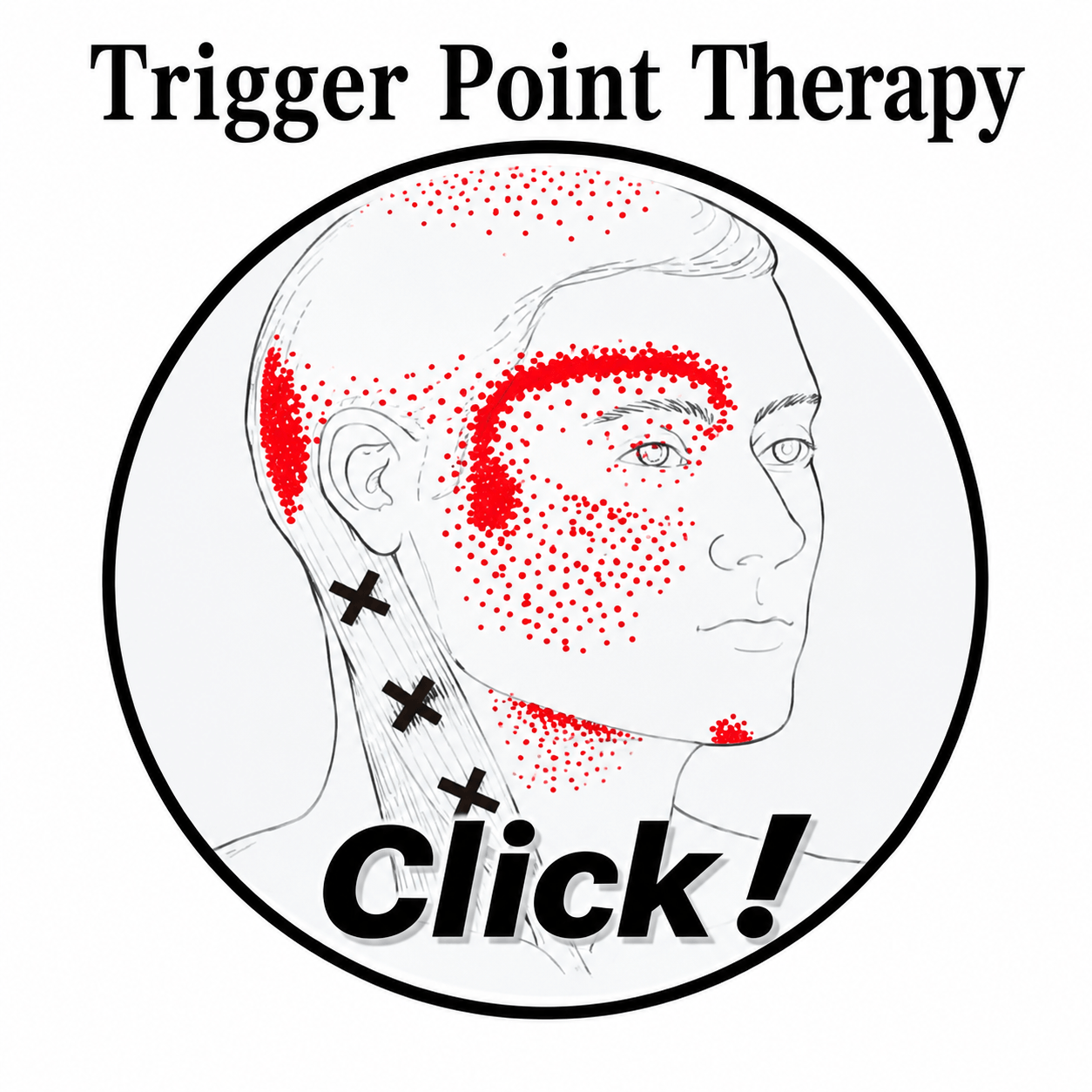 Illustration of facial and neck trigger points for Trigger Point Therapy at RENE Spa Bangkok